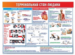 Стенд "Термінальний стан людини"